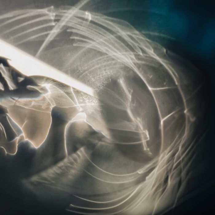 Scøpe, Xanexx, Ve Bogel – Unfaded